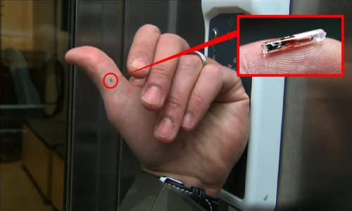 Microchip Implant